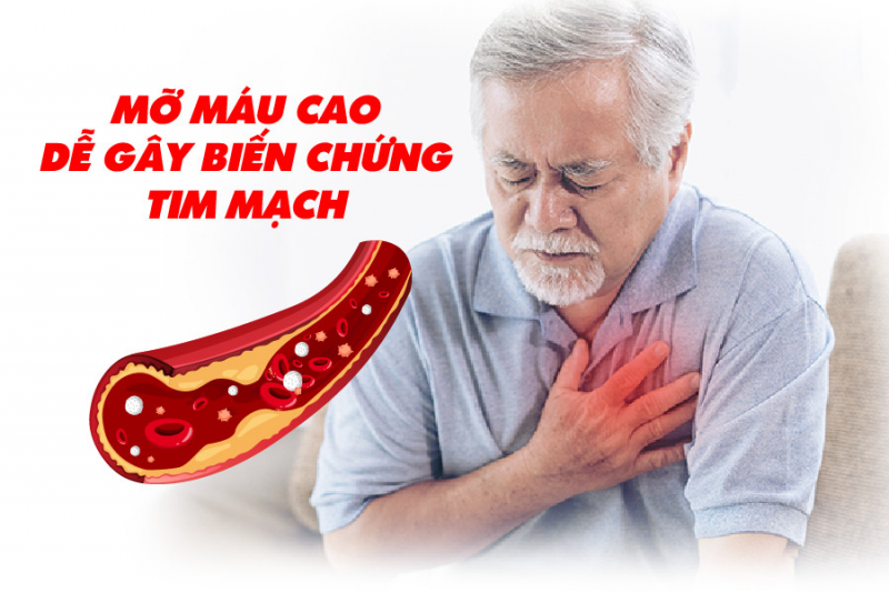 Mỡ Máu Cao? Nguyên Nhân, Triệu Chứng, Biến Chứng & Cách Điều Trị Hiệu Quả
